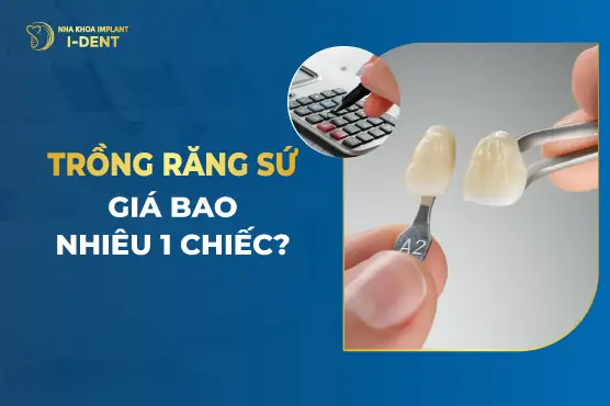 Trồng Răng Sứ Giá Bao Nhiêu 1 Chiếc? Bảng Giá Chi Tiết 2026 Từng Loại